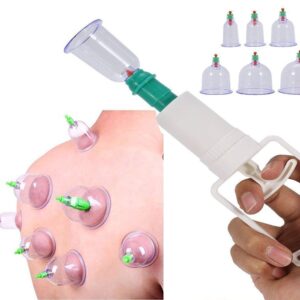 Сет за вакум масажа со 12 вендузи